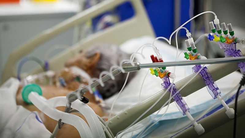 При закупке аппаратов ИВЛ работница больницы излишне оплатила поставщику почти 1,5 млн грн Фото: Getty Images
