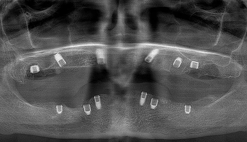 Какую стоматологию в Киеве выбрать: ответы на 5 вопросов пациентов
