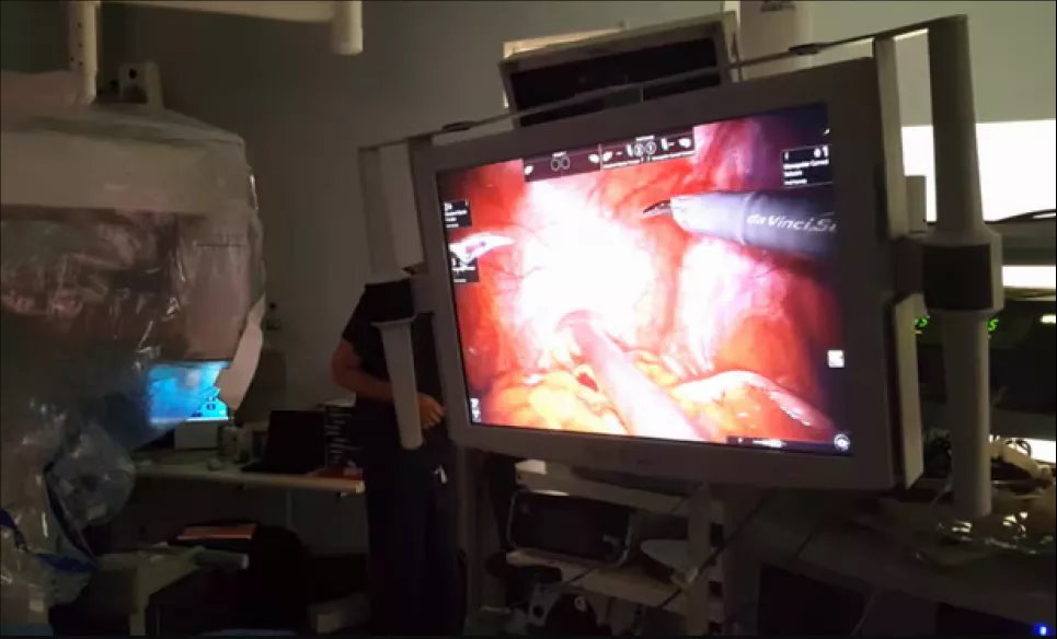 В исследовании ProMOTE пациенту проводят хирургическую операцию по удалению простаты с помощью робота. Фото: профессор Аластер Лемб/Оксфордский университет