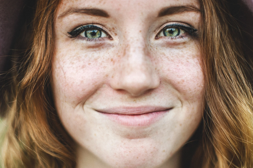 День любові до веснянок | Freckle day