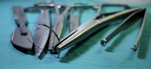 Львовские хирурги вырезали гигантскую кистому: опухоль занимала почти всю брюшную полость
