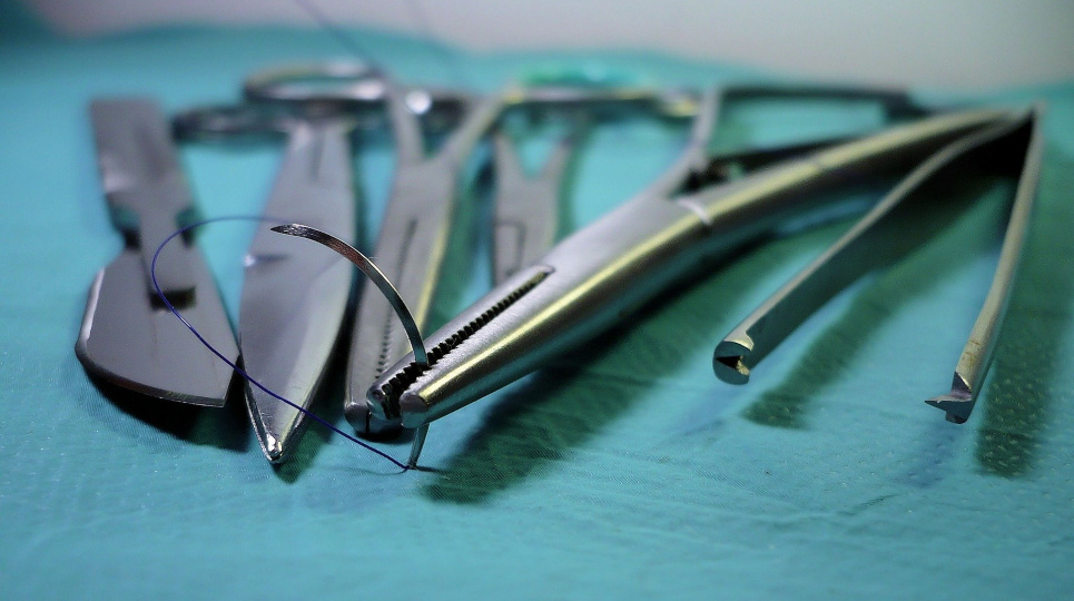 Львовские хирурги вырезали гигантскую кистому: опухоль занимала почти всю брюшную полость