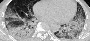Фото: pubs.rsna.org