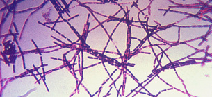 Збудники сибірки палички Bacillus anthracis.