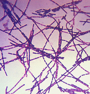 На Одещині виявлено сибірську виразку Збудники сибірки палички Bacillus anthracis.