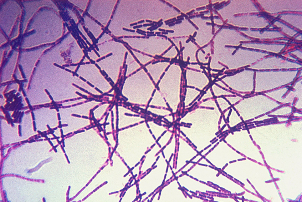 Возбудители сибирской язвы палочки Bacillus anthracis.