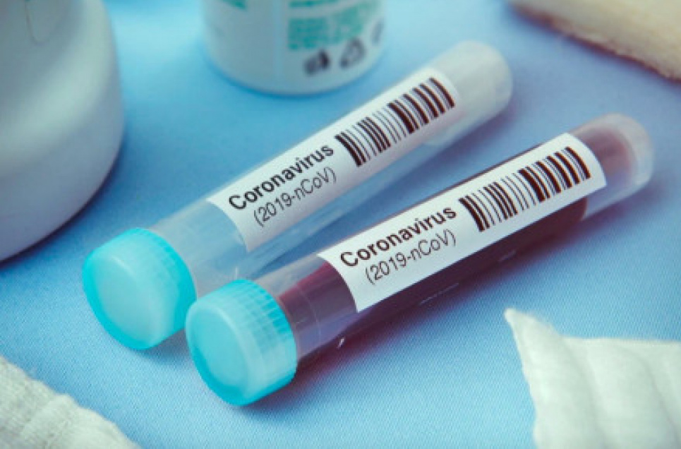 В Україні хворих на COVID-19 вже більше ніж в Канаді та Ізраїлі