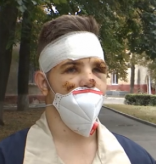 Хлопець дивом вижив та розповів про останні хвилин перед авіатрощею під Харковом (відео)
