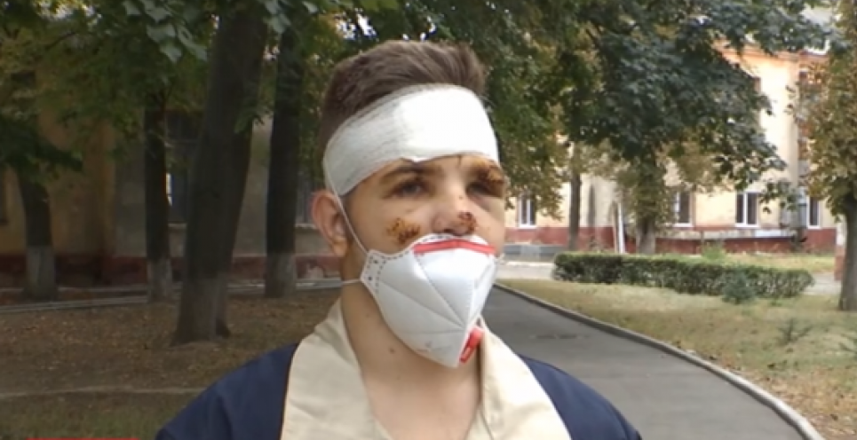 Хлопець дивом вижив та розповів про останні хвилин перед авіатрощею під Харковом (відео)
