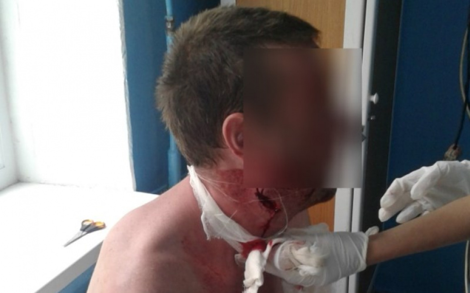 На Одещині вчителька довела учня й він перерізав собі горлянку прямо у школі