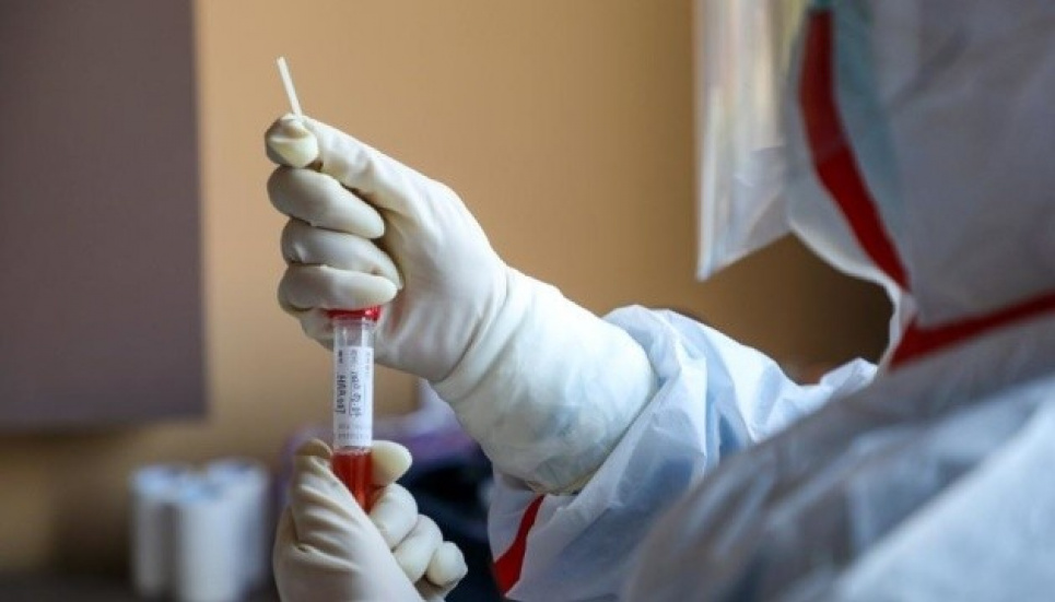 У МОЗ розповіли про можливу "побочку" від китайської вакцини CoronaVac