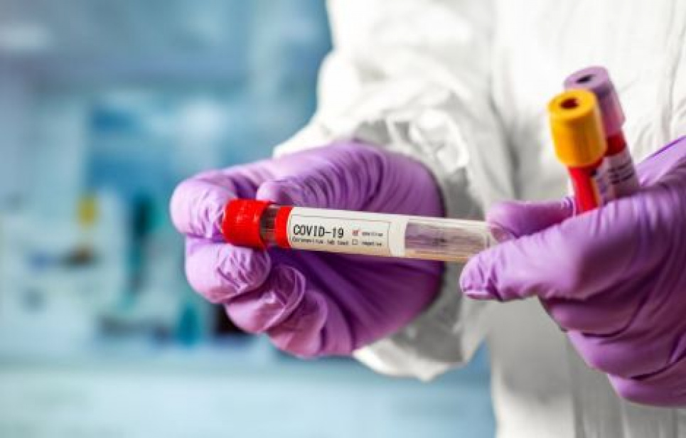 Дистанция более 1,5 метра не защищает от COVID-19