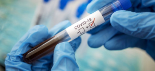 COVID-19 Віруси Нові випадки захворювання Статистика МОЗ