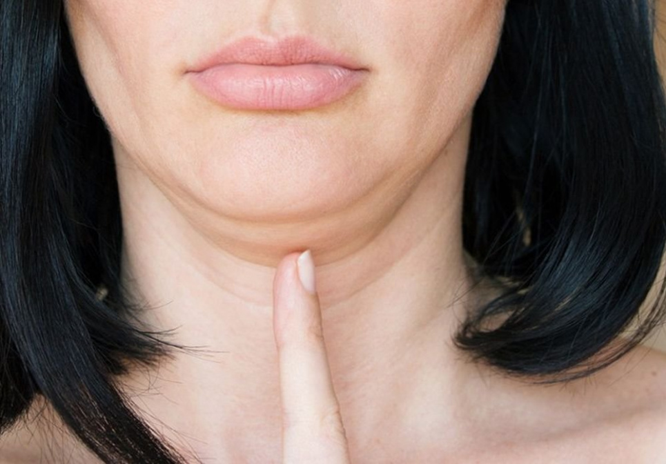 Лікарі порадили ТОП-5 способів прибрати подвійне підборіддя