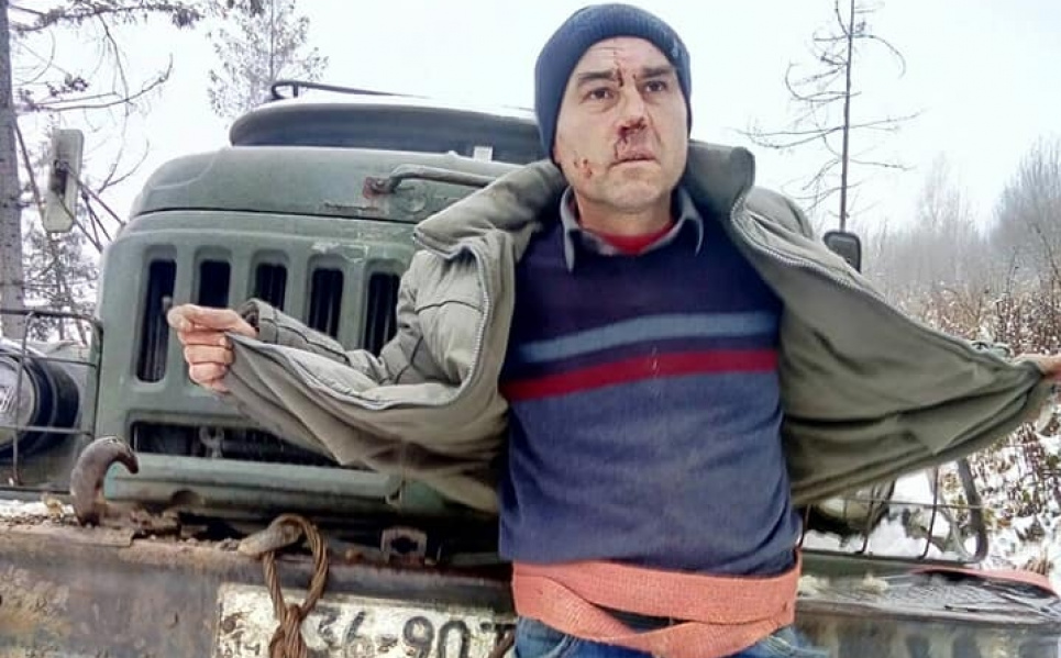 Лесорубы чуть не убили активиста, препятствовавшего рубке леса (фото 18+) Фото: Владимир Явдик