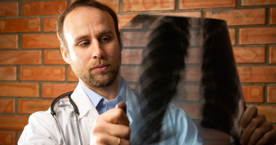 Відомий інфекціоніст пояснив, чому кількість хворих на COVID зменшується, а померлих зростає