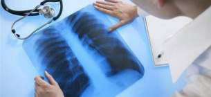 Туберкулез в Украине — в Нацслужбе здоровья назвали сумму, которую выделят из бюджета на лечение каждого больного