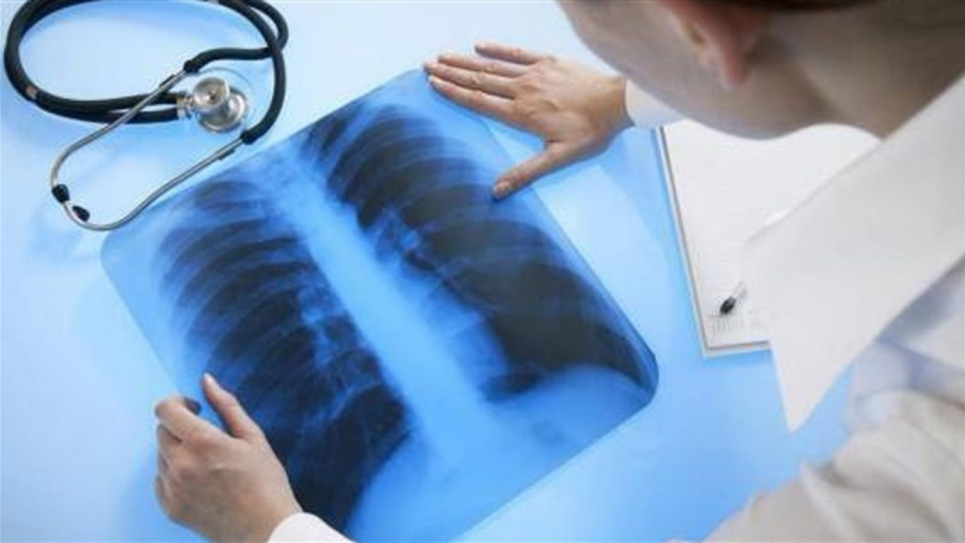 Туберкулез в Украине — в Нацслужбе здоровья назвали сумму, которую выделят из бюджета на лечение каждого больного