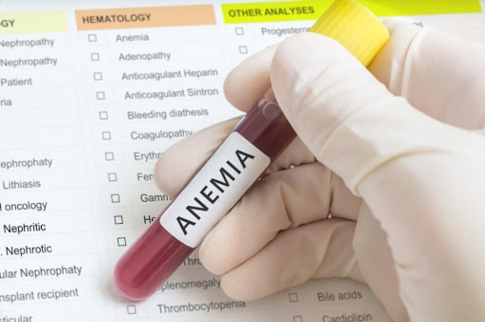 Залізодефіцитна анемія: симптоми, причини і способи лікування 