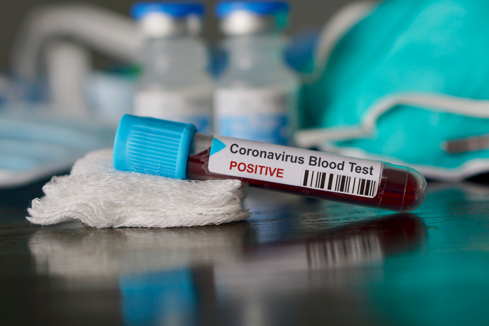 В Україні виявили понад 5 тисяч нових випадків коронавірусу