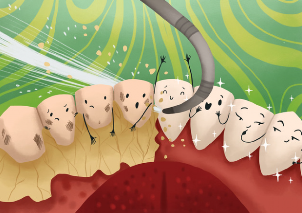 Состав слюны влияет на образование зубного камня — стоматолог