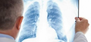 Лікарі та пацієнти стали заручниками провальної політики держави у протидії туберкульозу за останні 15 років — експерт