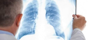 Кількість випадків туберкульозу за минулий рік в Україні