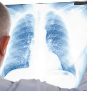 Центри діагностики на туберкульоз в Україні