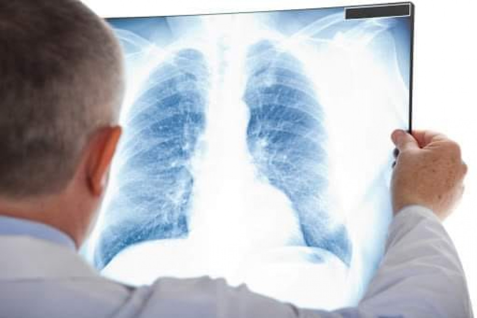 Туберкульоз в Україні Діагностика та лікування