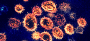 Частинки вірусу SARS-CoV-2, які викликають COVID-19