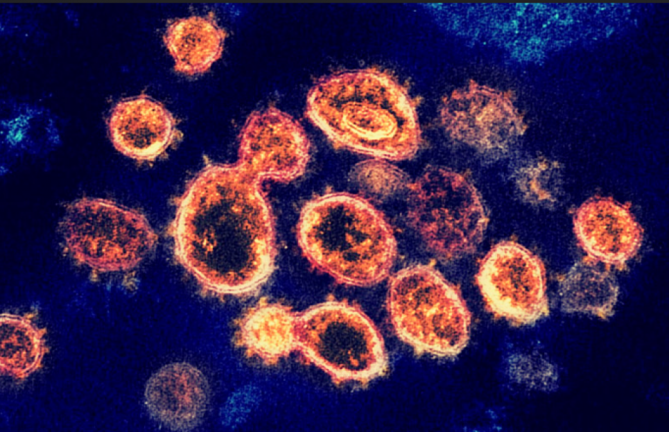 Частицы вируса SARS-CoV-2, которые вызывают COVID-19