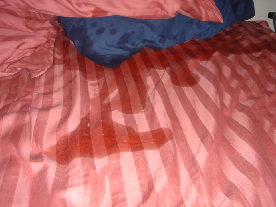 І діти, й дорослі не застраховані від проблеми «мокрого ліжка»: лікар радить, як цьому запобігти