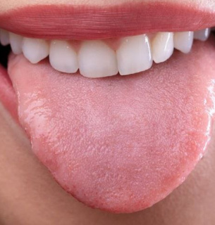 Які причини нальоту на язику