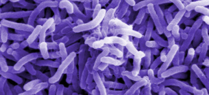 Vibrio cholerae — холерний вібріон під електронним мікроскопом