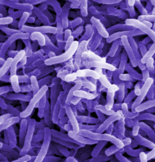В Україні посилено контроль за холерою Vibrio cholerae — холерний вібріон під електронним мікроскопом.