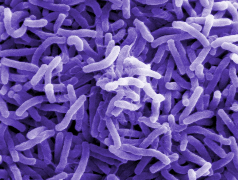 Vibrio cholerae — холерний вібріон під електронним мікроскопом