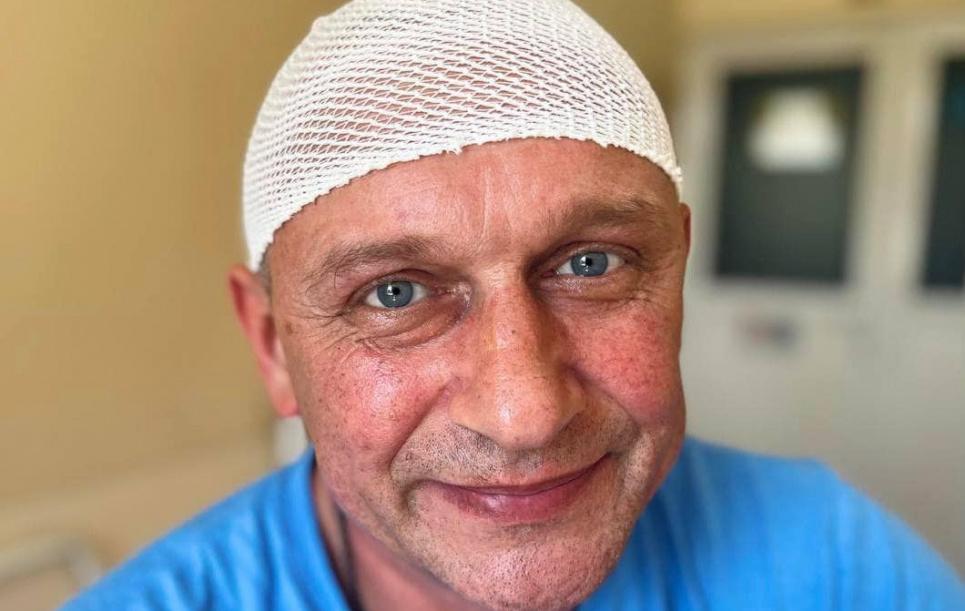 Чоловік не зміг поїхати на фронт через пухлину в мозку, яку виявив під час військового навчання
