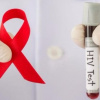 Всемирный день борьбы со СПИДом: статистика и проблематика