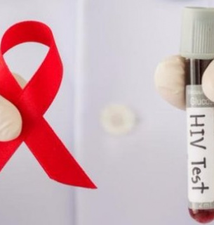 ВИЧ Умерли от СПИДа Статистика заболеваемости