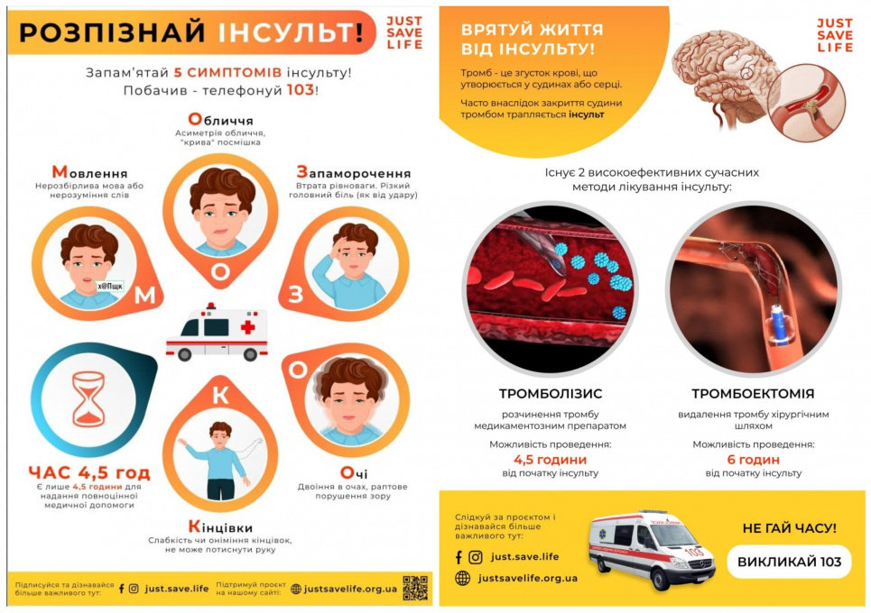Український хірург створив бот для визначення інсульту