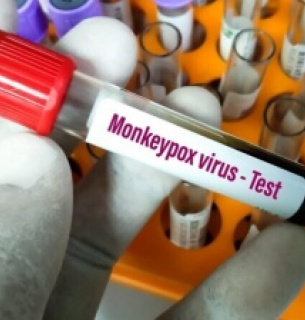 Смертельний випадок Мавп'яча віспа Хвороби Віруси Африка