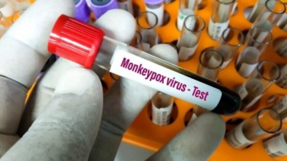 У Африці зафіксовано перший смертельний випадок від віспи мавп Смертельний випадок Мавп'яча віспа Хвороби Віруси Африка