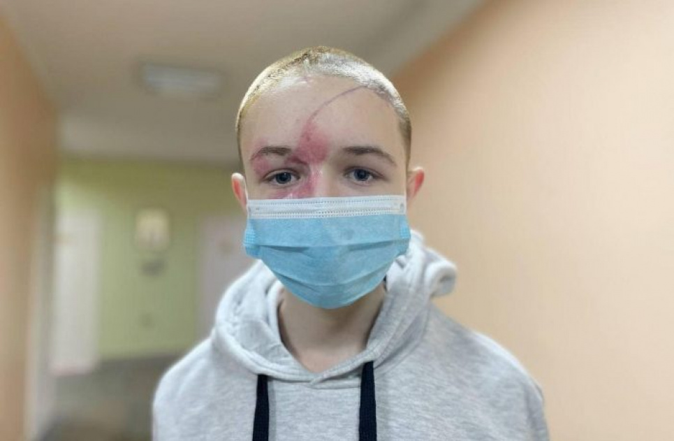 Ледь живого дістали з-під завалів: у Львові врятували життя підлітку після 9 днів в комі