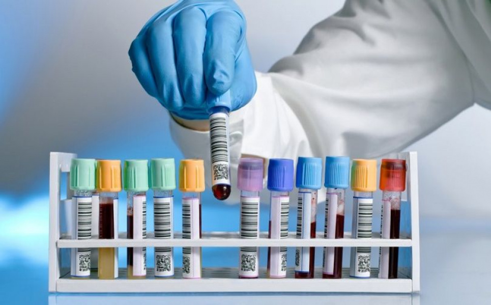 Як в Україні зробити аналізи на гормони безкоштовно, деталі