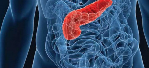 Перші ознаки запалення і раку підшлункової залози 