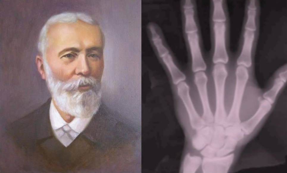 Український винахідник «рентгену» хто він 