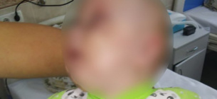 Мать сломала челюсть четырехмесячной донышки