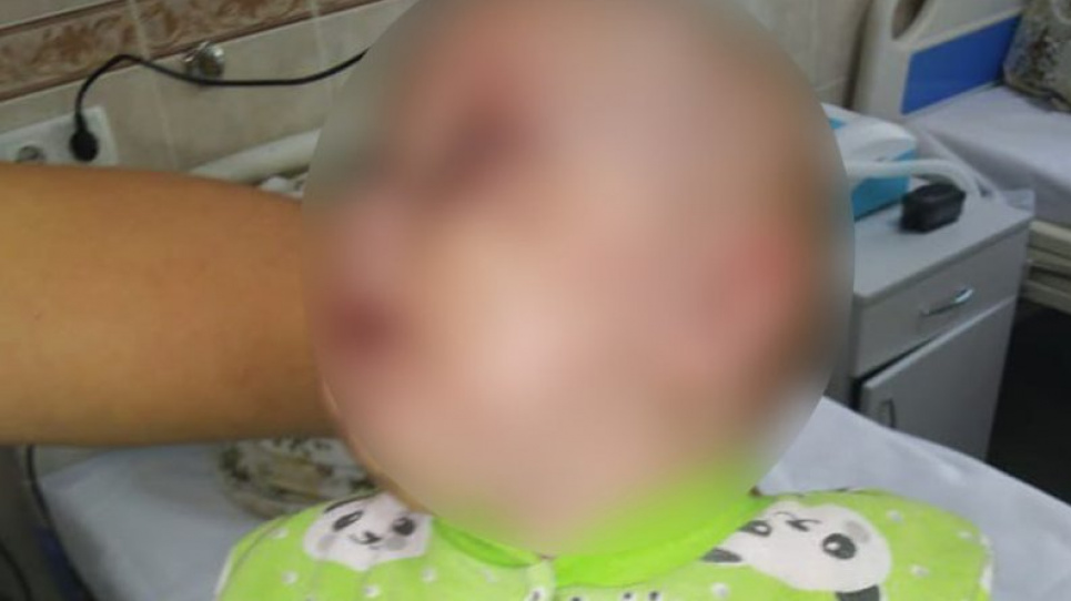 На Черкащині матір зламала щелепу чотиримісячній доньці, бо та плакала Матір зламала щелепу чотиримісячній донці