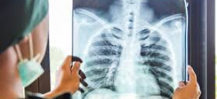 Найпоширеніші фактори ризику обструктивного захворювання легень