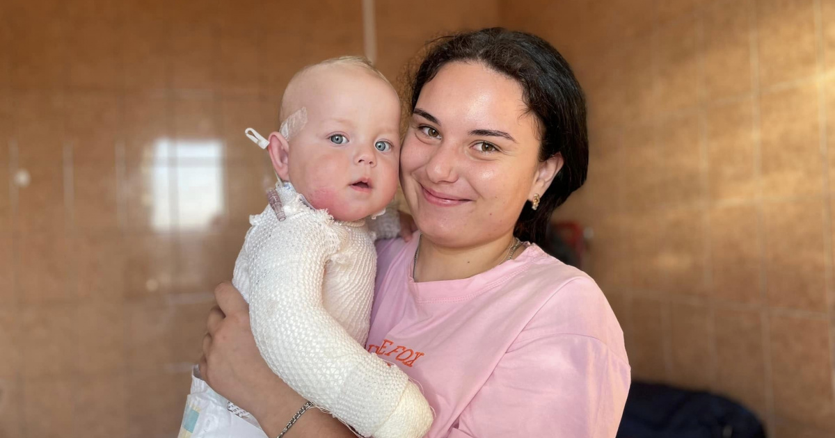 Лазер для шлифования рубцов во Львове | GreenPost